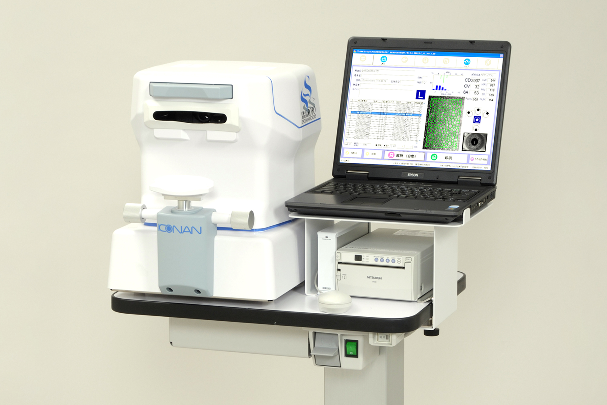 角膜内皮細胞検査