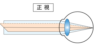 正視